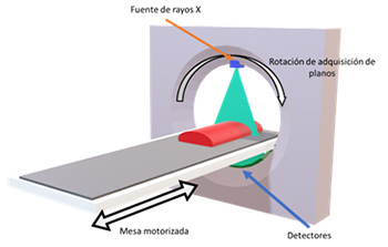 “detect